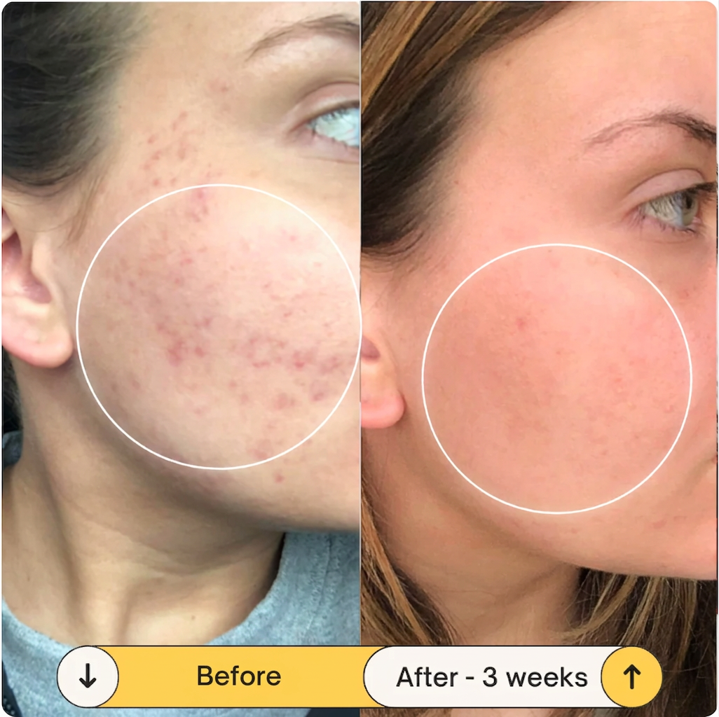 LuminaLift, Radiance Serum