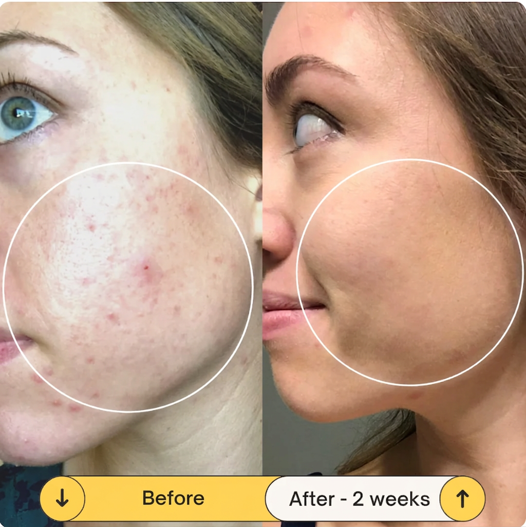 LuminaLift, Radiance Serum