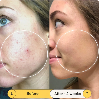 LuminaLift, Radiance Serum